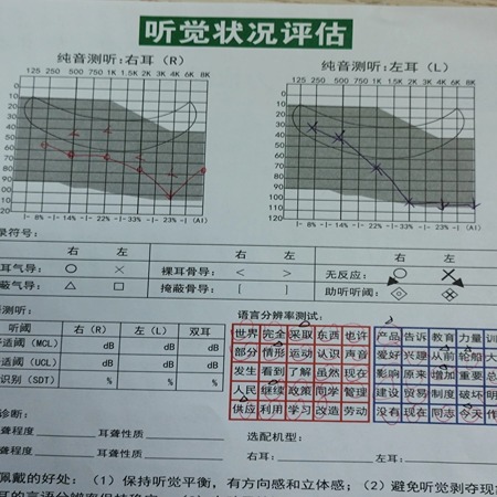 助听器之缘：重拾清晰听力的温暖故事